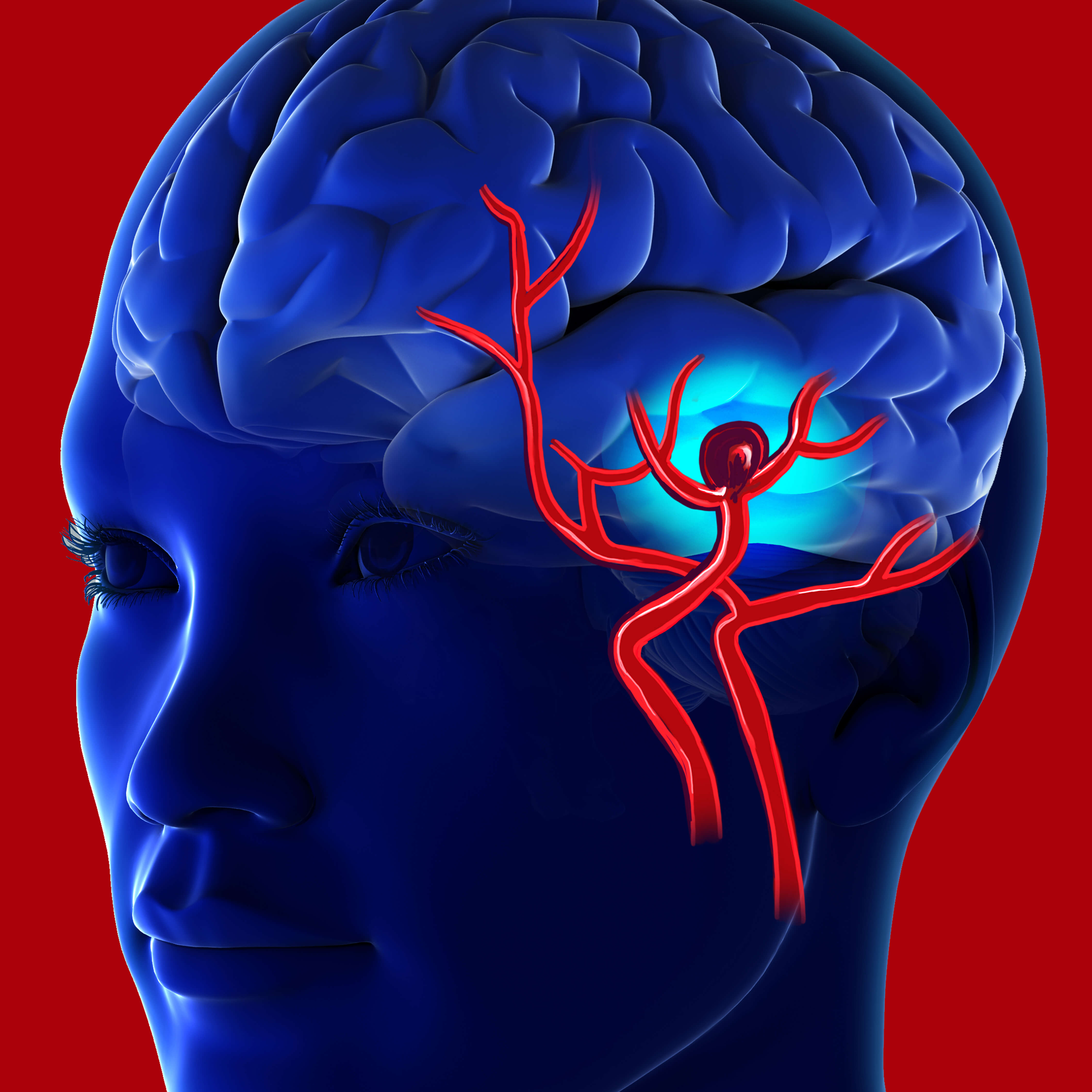 Видео сосудов головного мозга. Аневризма головного мозга. Кровеносные сосуды головного мозга. Аневризмы сосудов мозга.